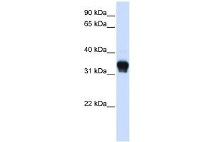 CK1 alpha 1 antibody used at 1 ug/ml to detect target protein. (CK1 alpha 1 (C-Term) 抗体)