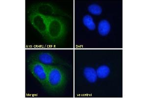 ABIN190893 Immunofluorescence analysis of paraformaldehyde fixed MCF7 cells, permeabilized with 0. (CRHR1 抗体  (AA 250-263))