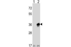Western Blotting (WB) image for anti-Myelin Protein Zero (MPZ) antibody (ABIN3003838) (MPZ 抗体)