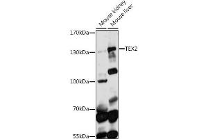 Western blot analysis of extracts of various cell lines, using TEX2 antibody (ABIN7270775) at 1:1000 dilution. (TEX2 抗体  (AA 915-1134))