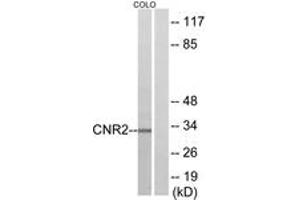Western blot analysis of extracts from COLO205 cells, using CNR2 Antibody. (CNR2 抗体  (AA 191-240))