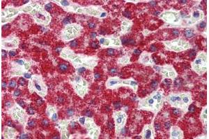 Liver, Human: Formalin-Fixed, Paraffin-Embedded (FFPE) (SH3BP2 抗体  (AA 432-481))