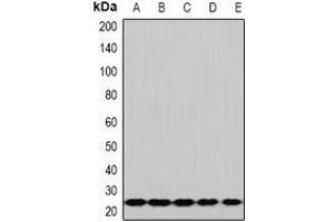 Western blot analysis of RPS5 expression in Hela (A), HepG2 (B), Jurkat (C), mouse spleen (D), mouse lung (E) whole cell lysates. (RPS5 抗体)