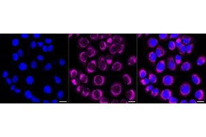 Immunocytochemical staining of HT- cells with PTPN1/2 antibody (ABIN7800964), 1:1,000). (Recombinant PTPN1/PTPN2 抗体)