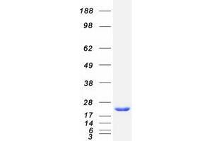 Western Blotting (WB) image for ADP-Ribosylation Factor 5 (ARF5) protein (Myc-DYKDDDDK Tag) (ABIN2714429)