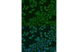 Immunofluorescence analysis of U2OS cells using PLG4C antibody (ABIN6132097, ABIN6145730, ABIN6145731 and ABIN6223698) at dilution of 1:100. (PLA2G4C 抗体  (AA 1-189))