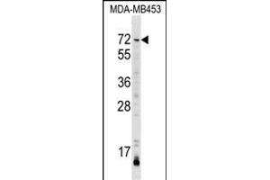 IGO3 Antibody (Center) (ABIN1538166 and ABIN2849213) western blot analysis in MDA-M cell line lysates (35 μg/lane). (AMIGO3 抗体  (AA 242-268))