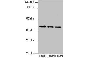 Western blot All lanes: RP2antibody at 3. (RP2 抗体  (AA 1-350))