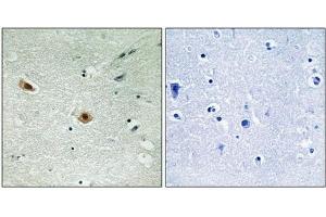 Immunohistochemical analysis of paraffin-embedded human brain tissue using Retinoblastoma (Phospho-Ser608) antibody (left)or the same antibody preincubated with blocking peptide (right). (Retinoblastoma 1 抗体  (pSer608))