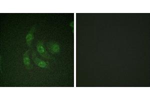 Peptide - +Immunofluorescence analysis of HepG2 cells, using CaMK4 (Ab-196/200) antibody. (CAMK4 抗体  (Thr196))