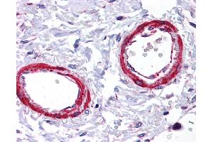 Immunohistochemistry (IHC) image for anti-Sirtuin 5 (SIRT5) (Middle Region) antibody (ABIN405300) (SIRT5 抗体  (Middle Region))