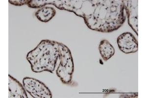 Image no. 1 for anti-Integrin-Linked Kinase-Associated Serine/threonine Phosphatase 2C (ILKAP) (AA 293-393) antibody (ABIN599593) (ILKAP 抗体  (AA 293-393))