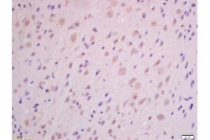 Formalin-fixed and paraffin embedded mouse brain labeled with Anti-GHRH Polyclonal Antibody, Unconjugated (ABIN726275) at 1:300 followed by conjugation to the secondary antibody and DAB staining. (GHRH 抗体  (AA 32-59))