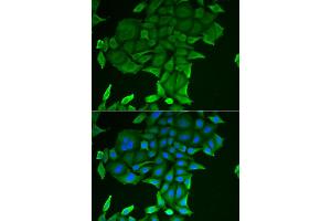 Immunofluorescence analysis of HeLa cells using CD84 antibody (ABIN5973833). (CD84 抗体)