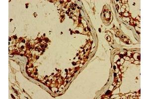 Immunohistochemistry of paraffin-embedded human testis tissue using ABIN7152561 at dilution of 1:100 (BRIP1 抗体  (AA 66-243))