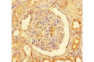 Immunohistochemistry of paraffin-embedded human kidney tissue using ABIN7146833 at dilution of 1:100 (CPT1A 抗体  (AA 301-600))