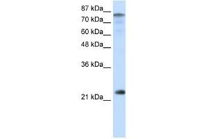 WB Suggested Anti-NFYB Antibody Titration:  0. (NFYB 抗体  (N-Term))