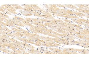 Detection of BMP2 in Human Cardiac Muscle Tissue using Polyclonal Antibody to Bone Morphogenetic Protein 2 (BMP2) (BMP2 抗体  (AA 24-396))