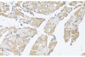 Immunohistochemistry of paraffin-embedded Mouse heart using ASMT Polyclonal Antibody at dilution of 1:100 (40x lens). (ASMT 抗体)