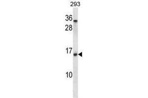 UBE2D2 Antibody (C-term) western blot analysis in 293 cell line lysates (35 µg/lane). (UBE2D2 抗体  (C-Term))