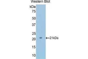 Western blot analysis of the recombinant protein. (TPT1 抗体  (AA 1-172))