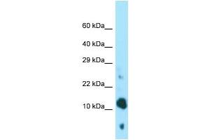 WB Suggested Anti-BEX4 Antibody Titration: 1. (BEX4 抗体  (N-Term))