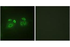 Immunofluorescence (IF) image for anti-Arrestin, beta 1 (ARRB1) (AA 369-418) antibody (ABIN2888645) (beta Arrestin 1 抗体  (AA 369-418))