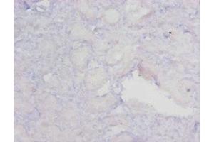 Immunohistochemistry of paraffin-embedded human kidney tissue using ABIN7159622 at dilution of 1:20 (MGMT 抗体  (AA 4-207))