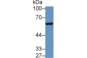 Western Blot; Sample: Mouse Placenta lysate; Primary Ab: 1µg/ml Rabbit Anti-Mouse IL9R Antibody Second Ab: 0. (IL9 Receptor 抗体  (AA 47-257))
