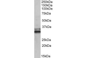 ABIN571194 (0. (ETFA 抗体  (AA 139-152))