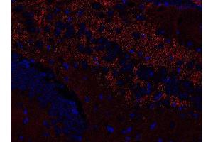 Indirect immunostaining of PFA fixed paraffin embedded mouse hippocampus section (dilution 1 : 500; red). (VAMP1, 2, 3 (AA 1-81) 抗体)