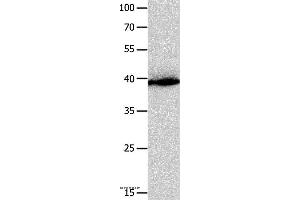 Western blot analysis of Human liver cancer tissue, using CFHR1 Polyclonal Antibody at dilution of 1:300 (CFHR1 抗体)