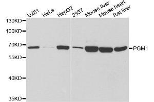 Western Blotting (WB) image for anti-Phosphoglucomutase 1 (PGM1) antibody (ABIN1980319) (Phosphoglucomutase 1 抗体)
