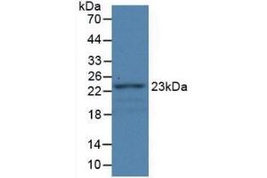 Western Blot; Sample: Recombinant FBLN1, Rat. (Fibulin 1 抗体  (AA 347-521))