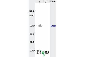 SDS-PAGE (SDS) image for anti-Solute Carrier Family 16 (Monocarboxylic Acid Transporters), Member 3 (SLC16A3) (AA 401-465) antibody (ABIN749303)