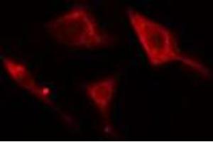 ABIN6278812 staining Hela cells by IF/ICC. (Adenylate Kinase 5 抗体  (N-Term))