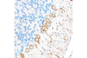 Immunohistochemistry of paraffin-embedded Mouse brain using MMP17 Rabbit pAb (ABIN3017219, ABIN3017220, ABIN3017221 and ABIN1680859) at dilution of 1:100 (40x lens). (MMP17 抗体)