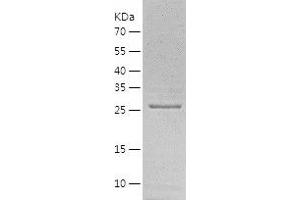 Western Blotting (WB) image for HUS1 Checkpoint Homolog (S. Pombe) (HUS1) (AA 1-280) protein (His tag) (ABIN7123371) (HUS1 Protein (AA 1-280) (His tag))