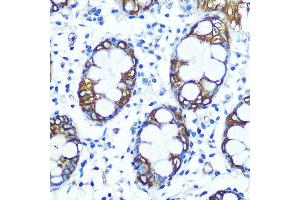 Immunohistochemistry of paraffin-embedded human colon using FUT4 Rabbit pAb (ABIN7267274) at dilution of 1:100 (40x lens). (CD15 抗体  (AA 200-300))