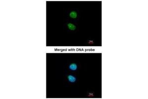 ICC/IF Image Immunofluorescence analysis of paraformaldehyde-fixed HeLa, using ZNF306 , antibody at 1:200 dilution. (ZKSCAN3 抗体)