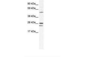 Image no. 1 for anti-Gap Junction Protein, beta 2, 26kDa (GJB2) (AA 85-134) antibody (ABIN202090) (GJB2 抗体  (AA 85-134))