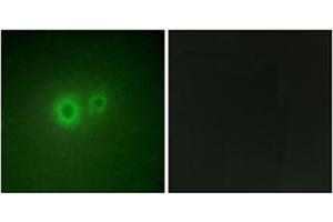 Immunofluorescence analysis of HuvEc cells, using LRAT Antibody . (LRAT 抗体  (Internal Region))