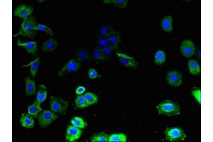 Immunofluorescent analysis of A431 cells using ABIN7153629 at dilution of 1:100 and Alexa Fluor 488-congugated AffiniPure Goat Anti-Rabbit IgG(H+L) (GJB7 抗体  (AA 41-75))