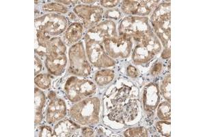 Immunohistochemical staining of human kidney with GINS4 polyclonal antibody  shows moderate cytopolasmic positivity in tubular cells. (GINS4 抗体)