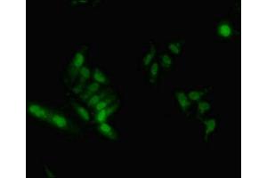 Immunofluorescent analysis of Hela cells using ABIN7155138 at dilution of 1:100 and Alexa Fluor 488-congugated AffiniPure Goat Anti-Rabbit IgG(H+L) (HNRNPA2B1 抗体  (AA 1-249))