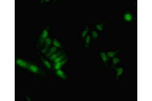 Immunofluorescent analysis of Hela cells using ABIN7155138 at dilution of 1:100 and Alexa Fluor 488-congugated AffiniPure Goat Anti-Rabbit IgG(H+L) (HNRNPA2B1 抗体  (AA 1-249))