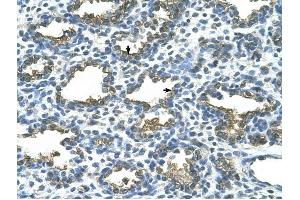 ALPP antibody was used for immunohistochemistry at a concentration of 4-8 ug/ml to stain Alveolar cells (arrows) in Human Lung. (PLAP 抗体)