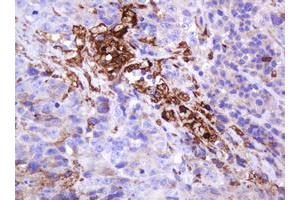 Image no. 2 for anti-Mucin 1 (MUC1) antibody (ABIN1499598) (MUC1 抗体)