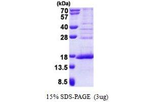 SDS-PAGE (SDS) image for Family With Sequence Similarity 119A (FAM119A) (AA 93-218) protein (His tag) (ABIN6387219)