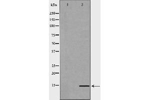 Western blot analysis of Hela whole cell lysates, using HIST2H2BE Antibody. (HIST2H2BE 抗体  (C-Term))